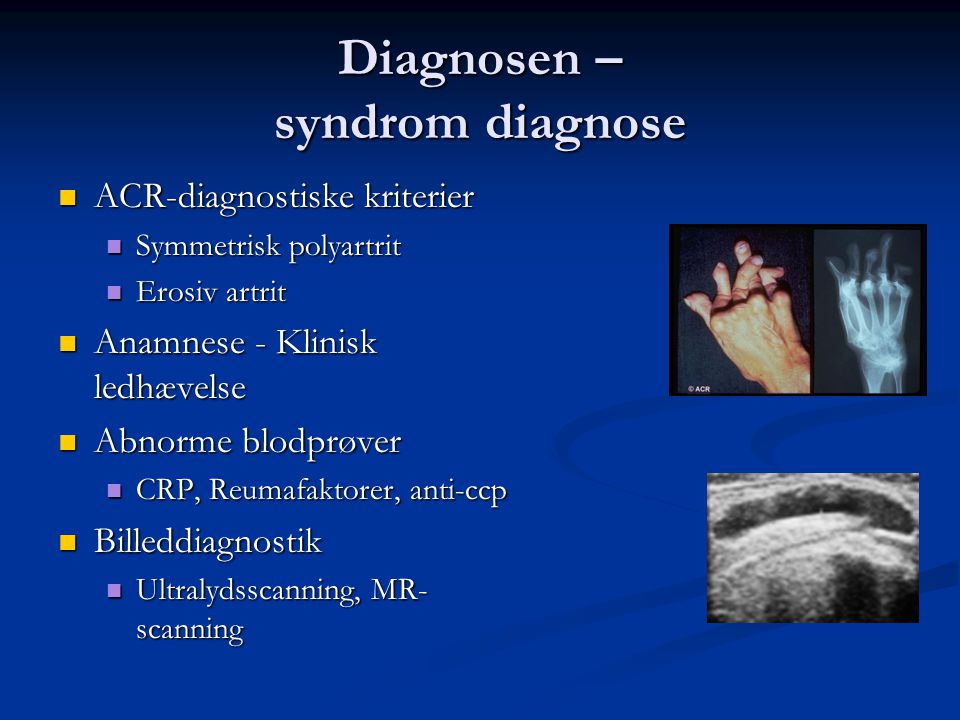 Diagnosen – syndrom diagnose