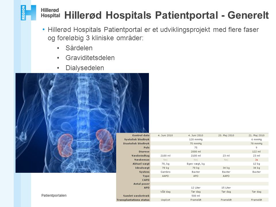 Hillerød Hospitals Patientportal - Generelt
