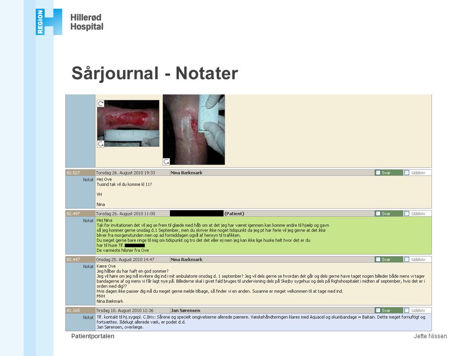 Sårjournal - Notater Patientportalen Jette Nissen