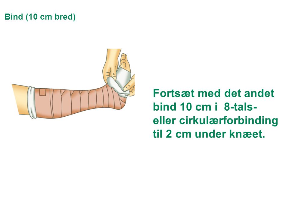 Bind (10 cm bred) Fortsæt med det andet bind 10 cm i 8-tals- eller cirkulærforbinding til 2 cm under knæet.