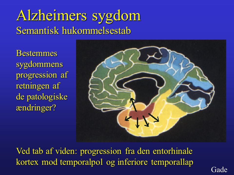 Alzheimers sygdom Semantisk hukommelsestab Bestemmes sygdommens