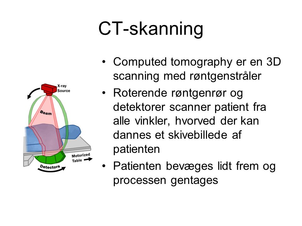 CT-skanning Computed tomography er en 3D scanning med røntgenstråler