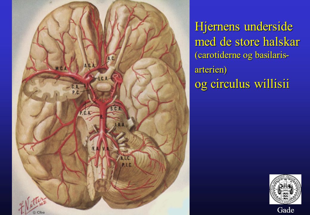 Hjernens underside med de store halskar og circulus willisii